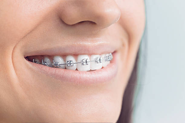 Best General Dentistry  in Chester, MD